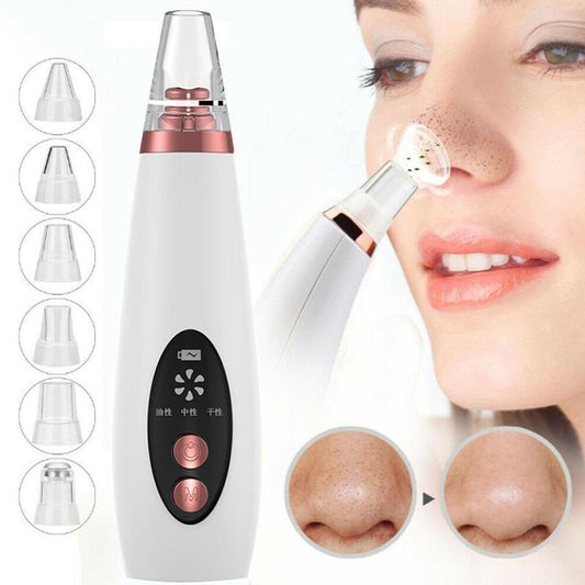 Blackhead Pore Vacuum Cleaner – Clear & Smooth Skin